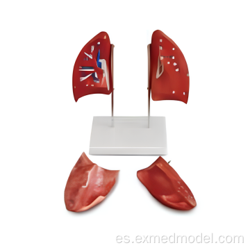 Modelo de anatomía pulmonar izquierda y derecha